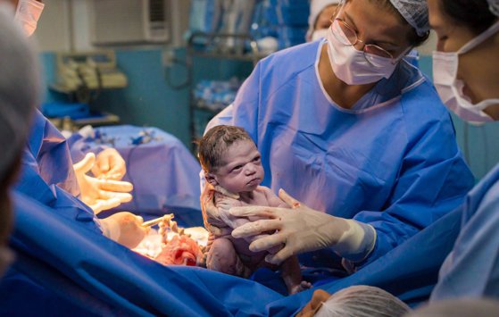 Un bebeluş brazilian a uimit cu gestul pe care l-a făcut imediat după ce s-a născut