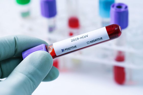 Medicii români au testat pentru coronavirus 351 de persoane. Doar 3 pacienţi, confirmaţi pozitiv