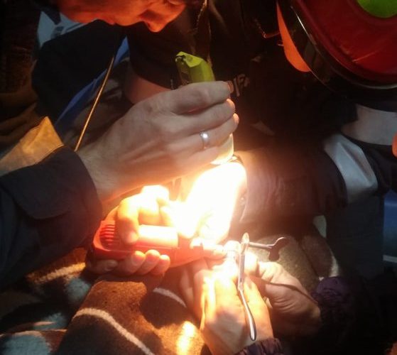 Intervenţie dificilă a pompierilor din Botoşani care au fost chemaţi să taie un inel de pe degetul unui copil | FOTO