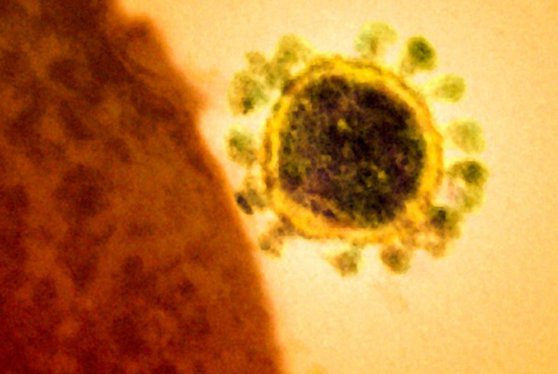 Australia raportează primul deces cauzat de coronavirus