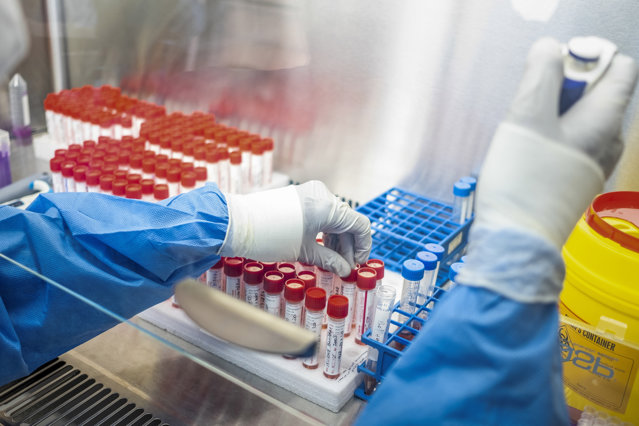 Jumătate dintre rezultatele testelor de salivă au fost confirmate PCR, în ultima săptămână