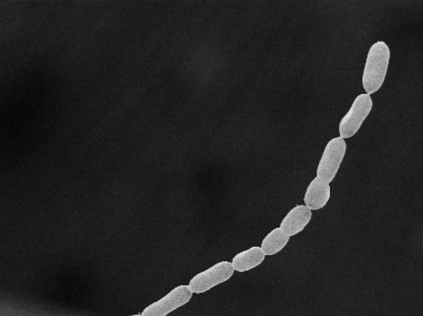 Bacteria gigantică vizibilă cu ochiul liber: atinge 2 centimetri, de 5.000 de ori mai mult decât alte bacterii