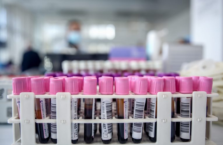 Un test de sânge ar putea detecta boala Parkinson înainte de apariția simptomelor
