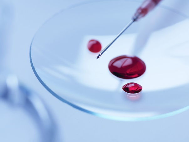Terapia care păcălește HIV și îl forțează într-o stare latentă permanentă