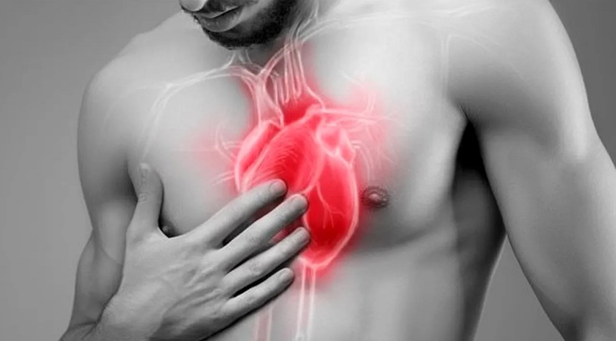 Legătura periculoasă dintre poluare și infarct, confirmată de cercetători