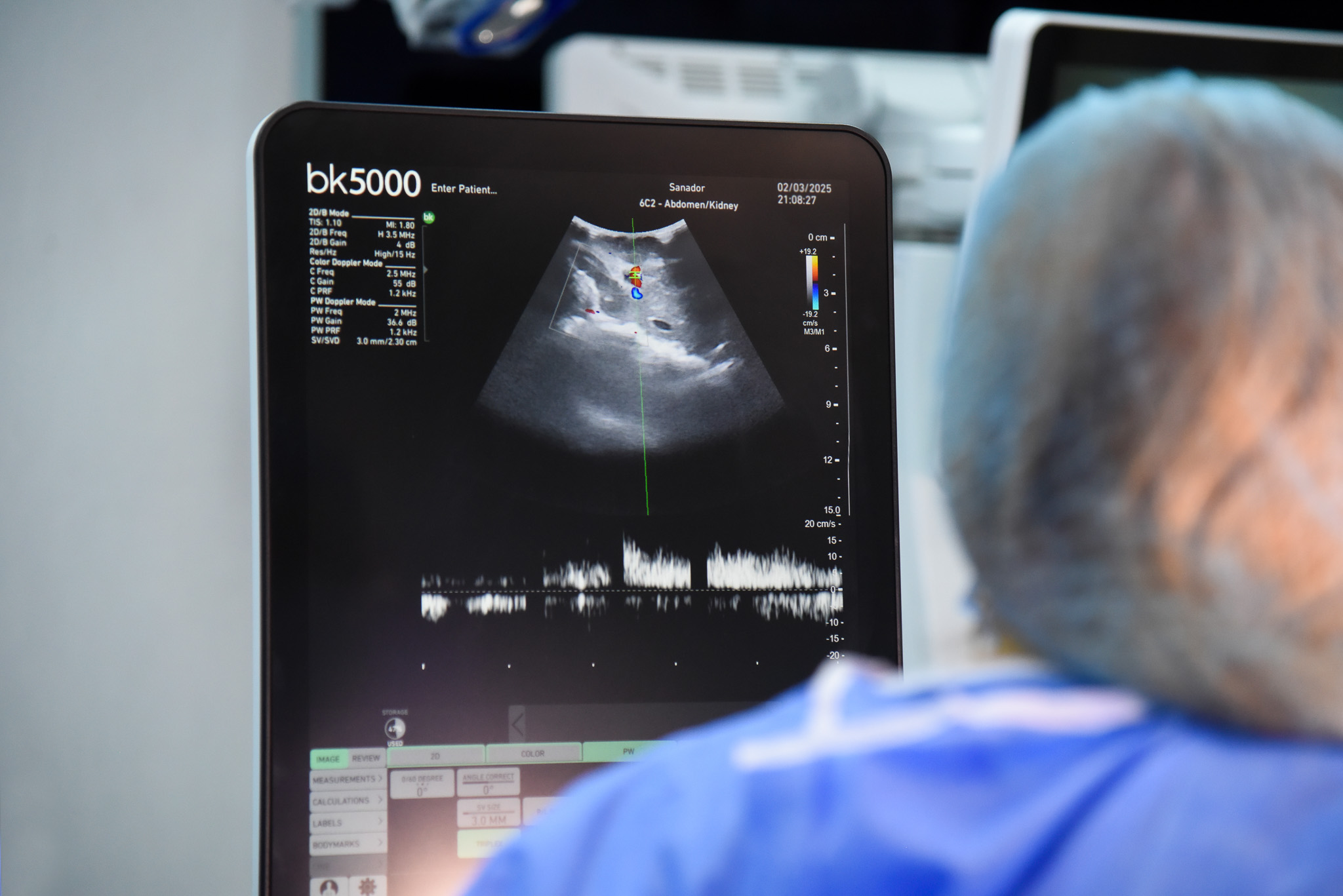 84 de donatori și aproape 300 de transplanturi în România de la începutul anului