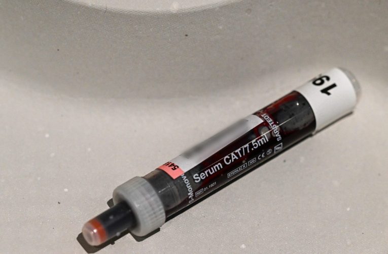 Europa nu testează și nu tratează HIV la timp. Țările din Est au înregistrat cele mai multe cazuri în ultimul an