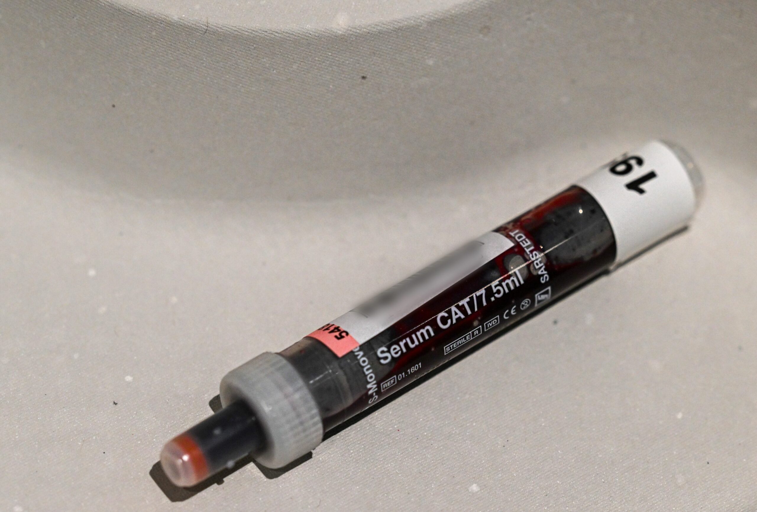 Europa nu testează și nu tratează HIV la timp. Țările din Est au înregistrat cele mai multe cazuri în ultimul an