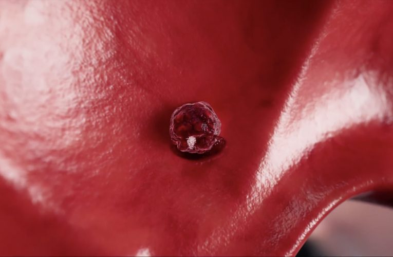 Studiu: Munca de noapte crește riscul de cancer