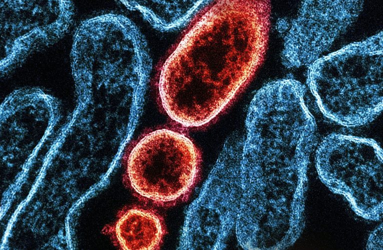 Controale amănunțite în aeroporturi din Asia după ce India anunță noi infecții cu virusul Nipah