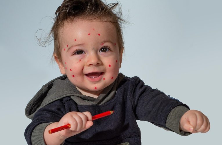 Vaccinarea împotriva varicelei devine obligatorie în Bulgaria