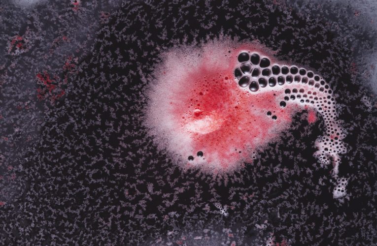 O bacterie comună în ochi ar putea provoca Alzheimer