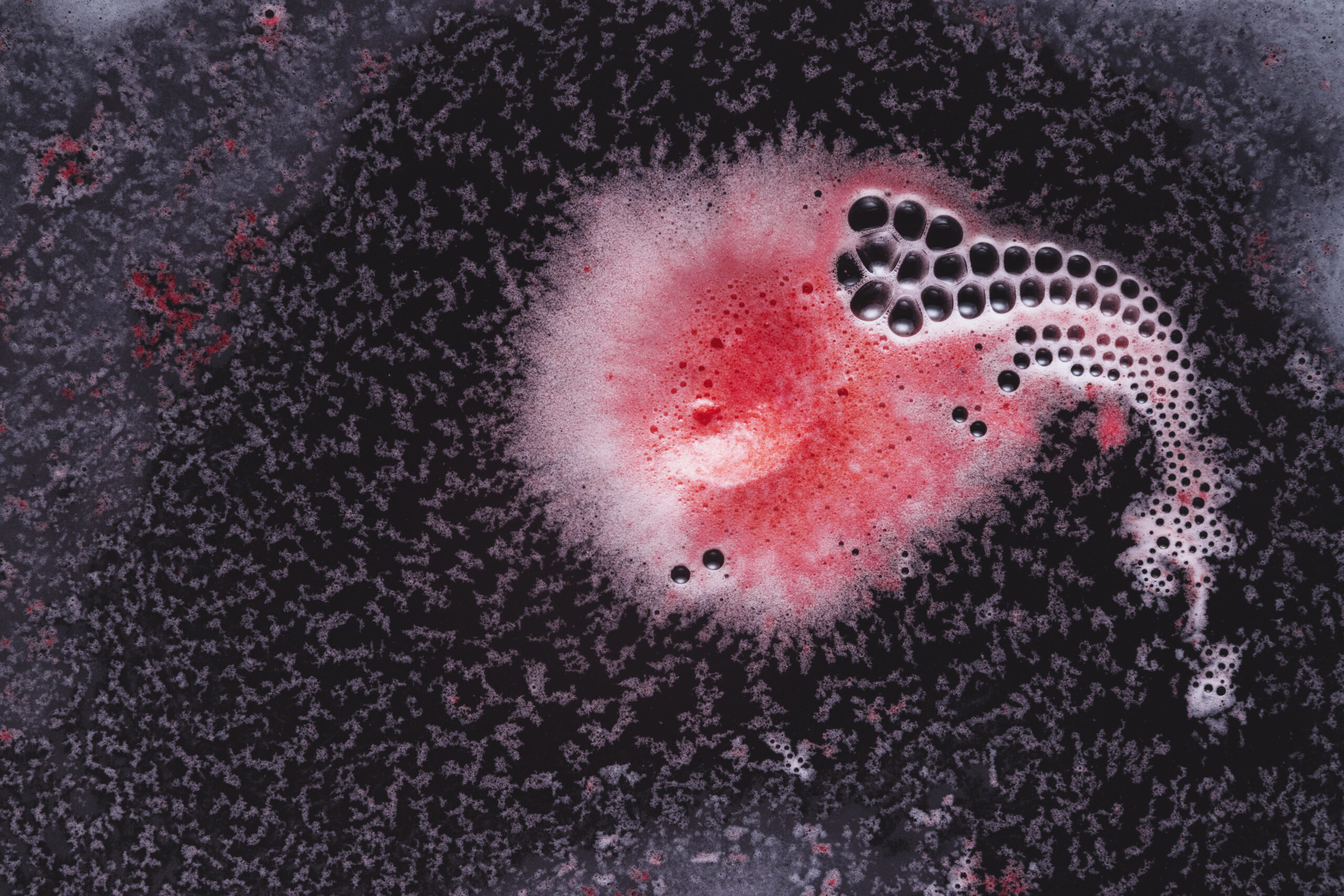 O bacterie comună în ochi ar putea provoca Alzheimer