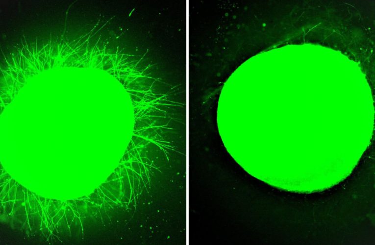 Un pas uriaș spre tratarea paraliziei: țesutul nervos uman s-a regenerat în laborator