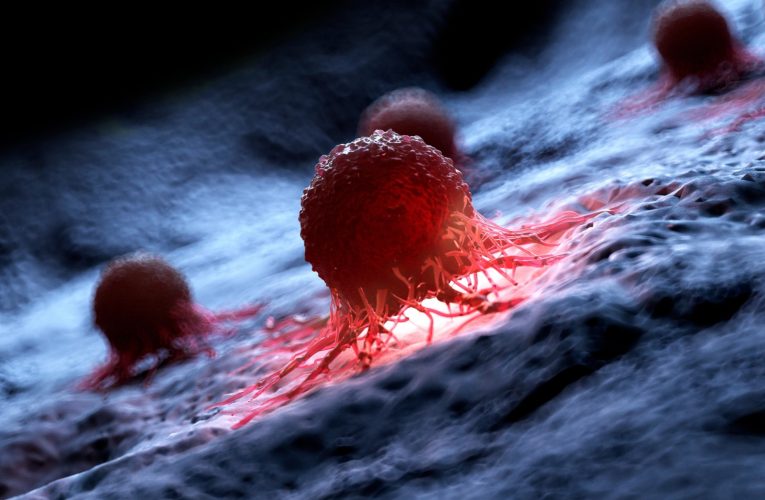 Un progres important ]n lupta cu cancerul: O nouă terapie care elimină tumorile, aflată în studii preclinice