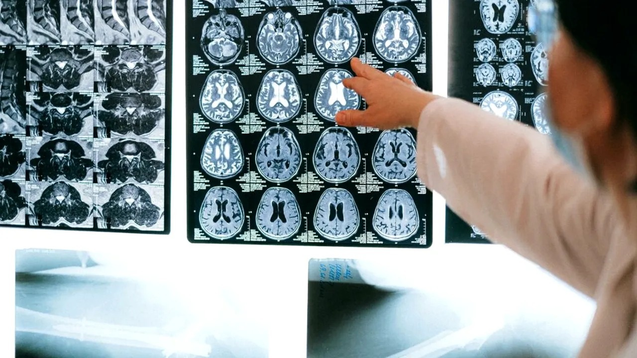 Descoperire în neuroștiință: un cercetător german explică modul în care funcționează sistemul de navigație al creierului uman