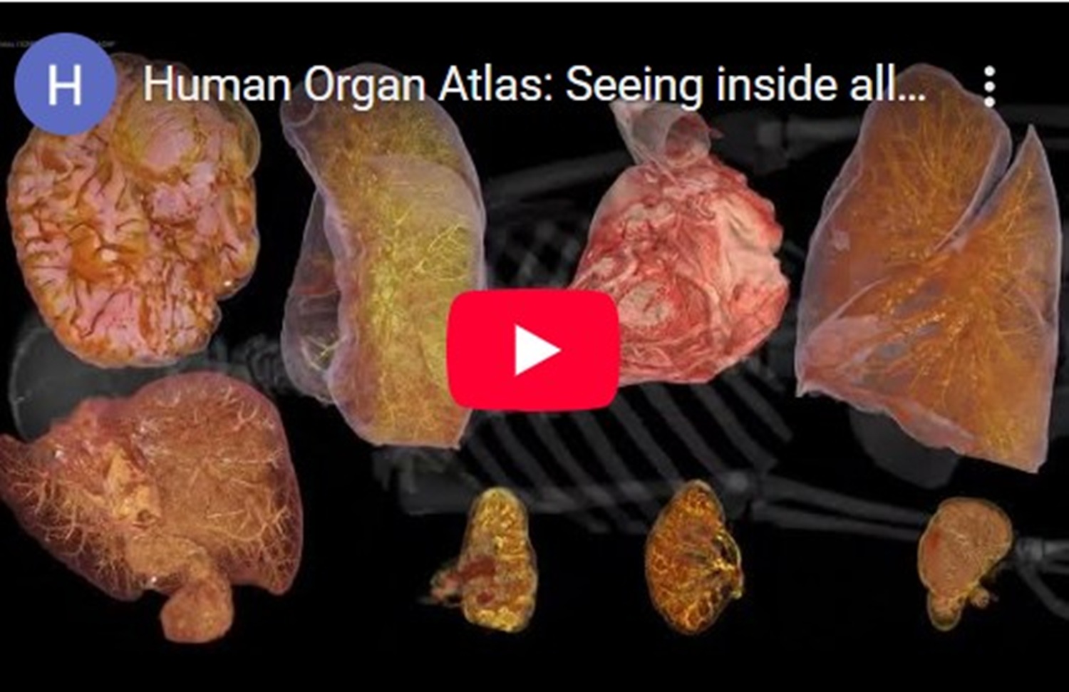 Human Organ Atlas, „Google Earth” al corpului uman. Cum arată organele la rezoluție aproape celulară