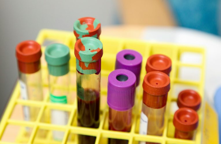 Aproape o treime din angajații în sănătate din Europa se confruntă cu risc de cancer la locul de muncă