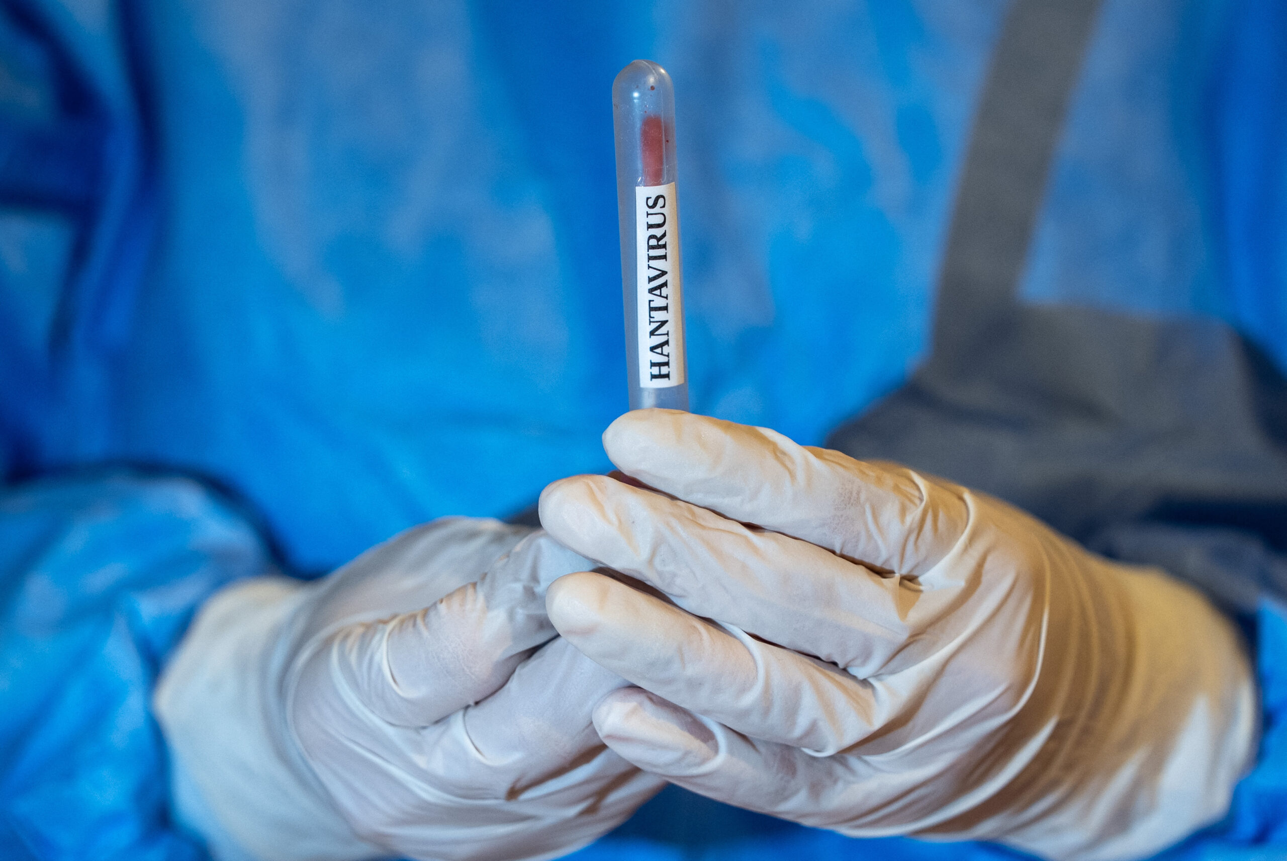 Caz de hantavirus confirmat la Arad. Pacientul a fost transferat de la un spital din Bihor. Precizările INSP