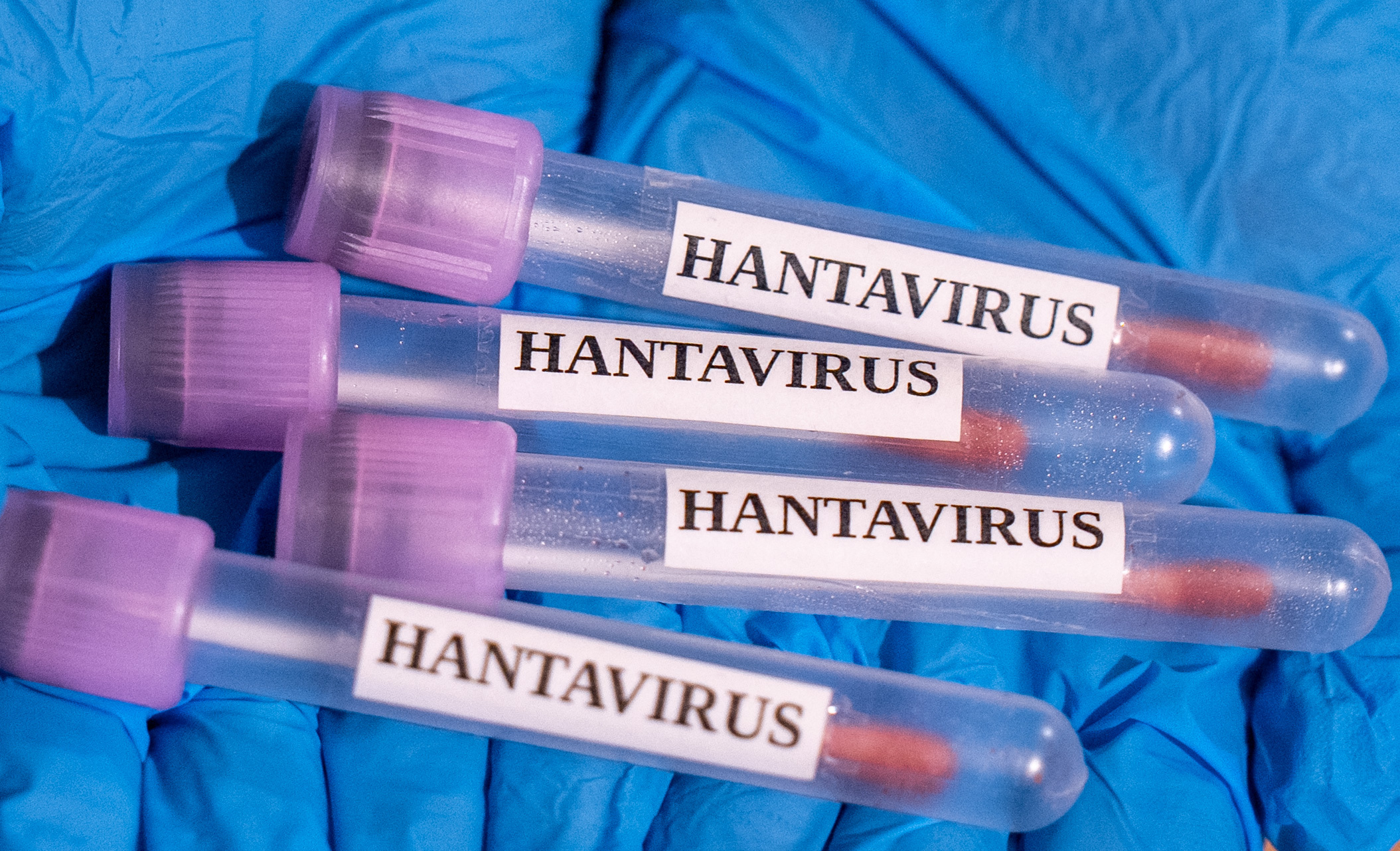 O însoțitoare de bord, internată în Amsterdam după ce a intrat în contact cu o victimă a focarului de hantavirus de pe vasul Hondius