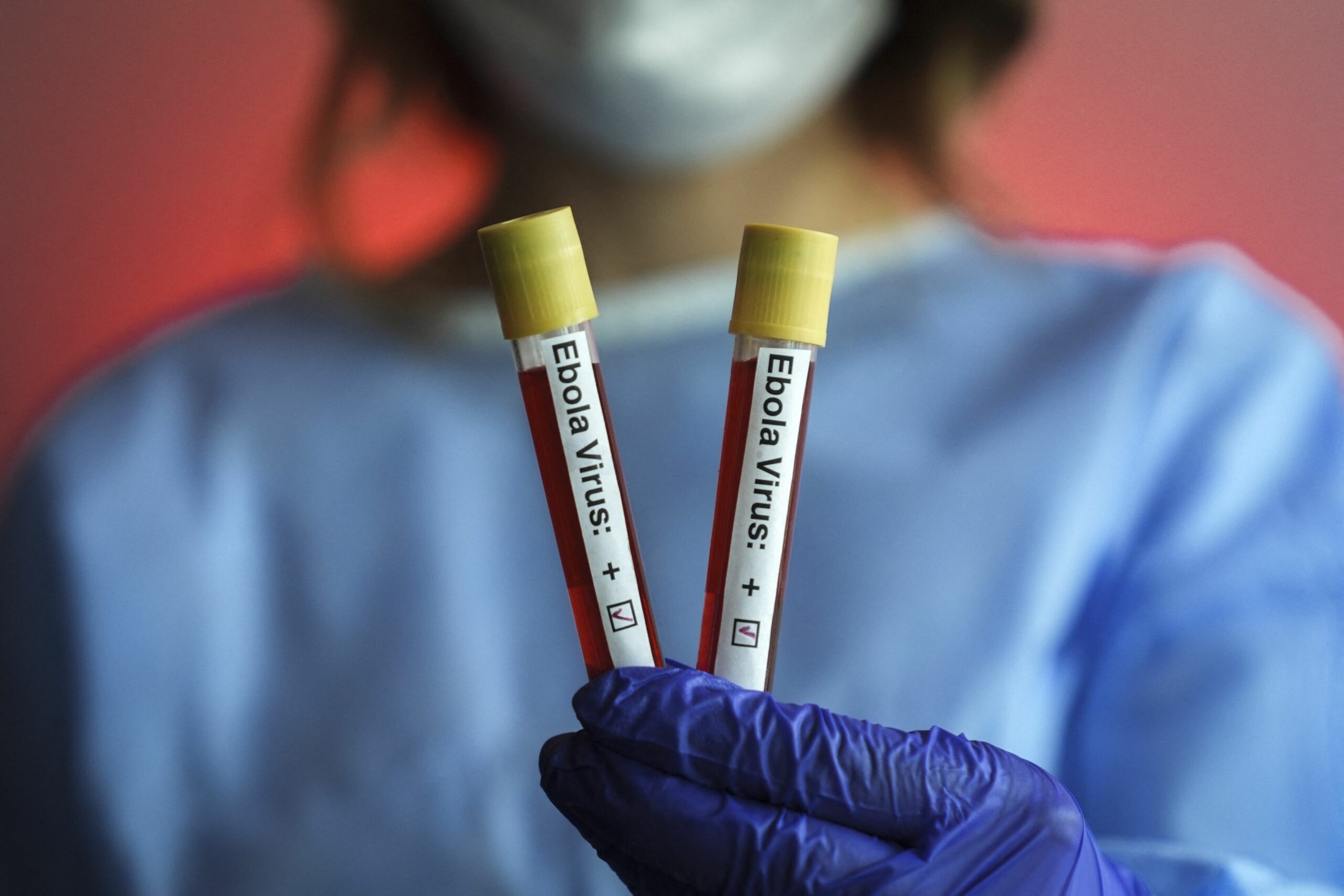 Ebola: Peste 1.000 de cazuri confirmate și 254 de decese în Congo